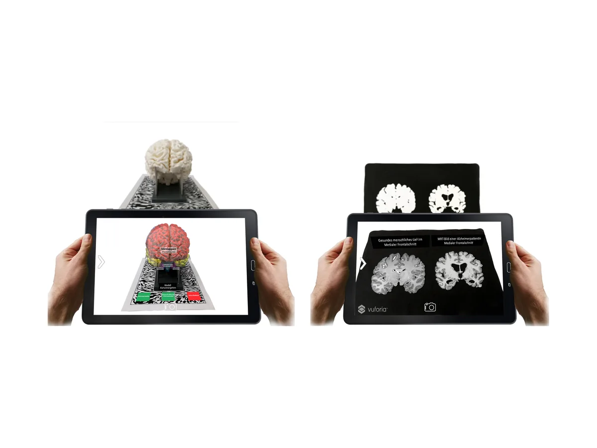 Zwei Tablets zeigen per Augmented Reality beschriftete Hirnareale am Modell und MRT-Bilder eines gesunden und eines erkrankten Gehirns